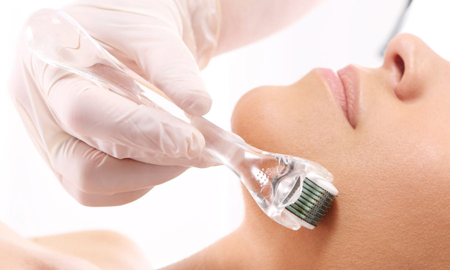 Welke lengte dermaroller heb ik nodig?