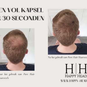 Het resultaat voor en na het gebruik van Pure Hair Haarvezels.