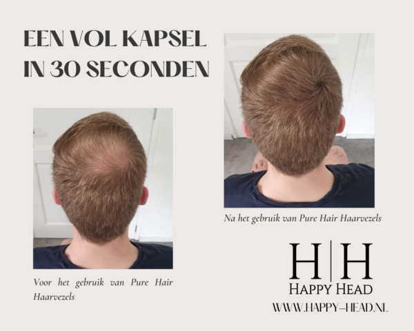 Het resultaat voor en na het gebruik van Pure Hair Haarvezels.