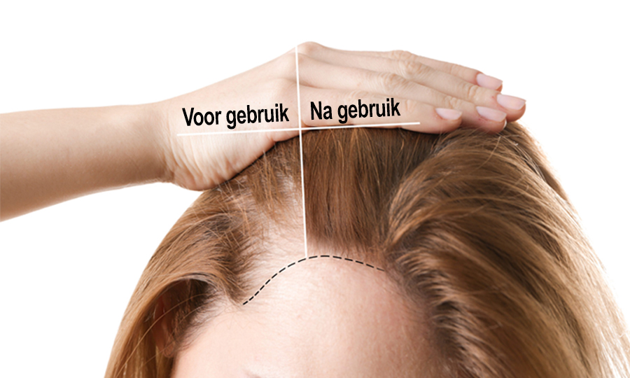 Zijn Keratine haarvezels veilig?