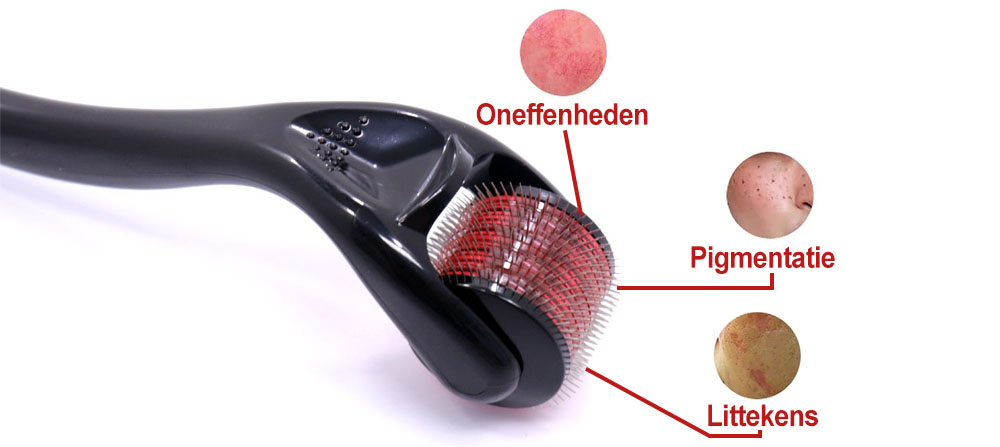 De voordelen van dermarollen