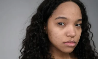 Beschadigde huid door acne